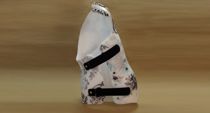 CharlestonSAM_skoliosi