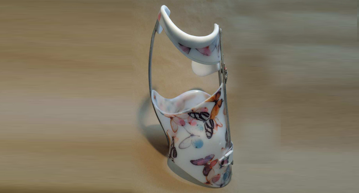 skoliosi-DB2-1-e1541014802909