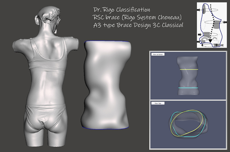 rigo-system-cheneau-info2